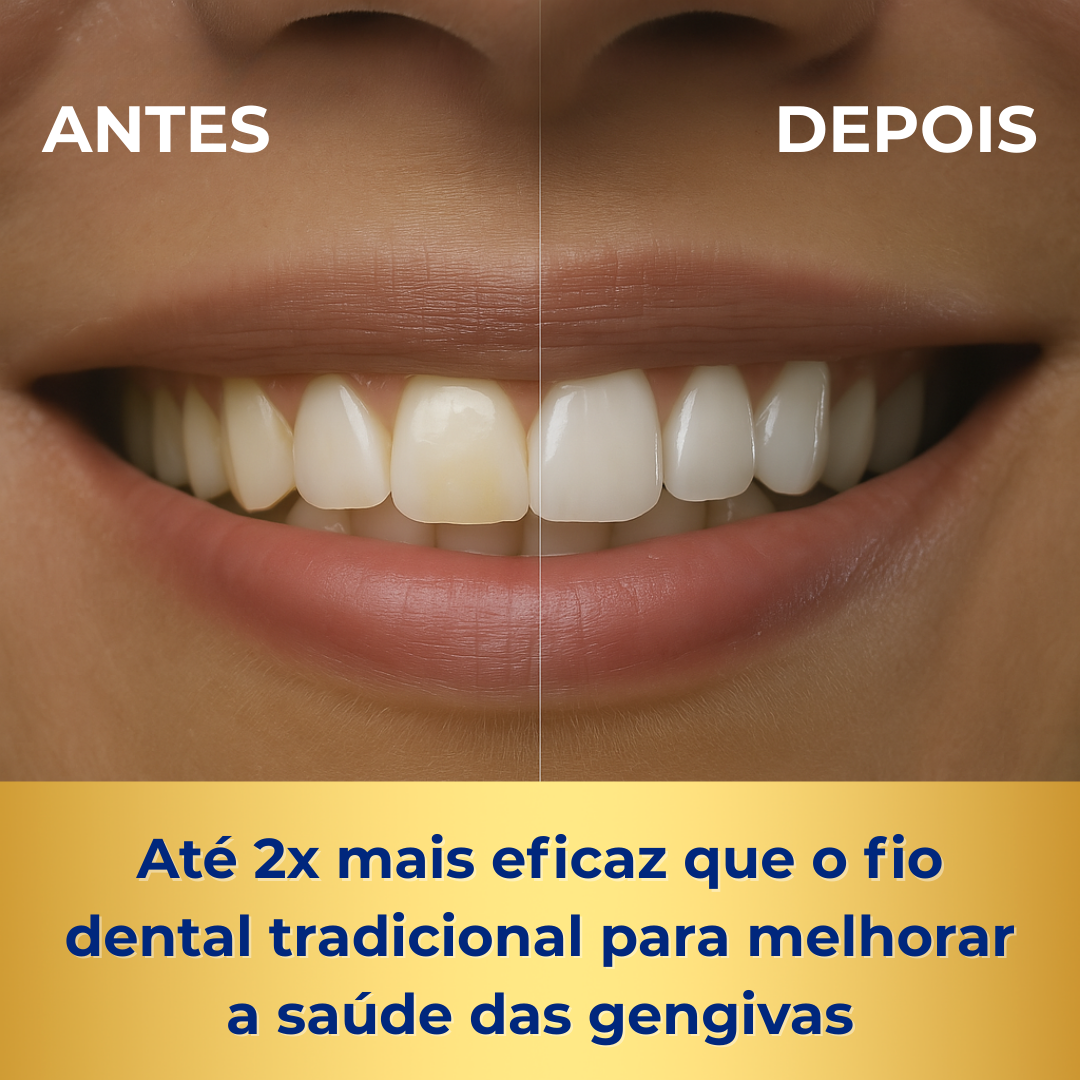 Irrigador Dental Jetfloss Ultra