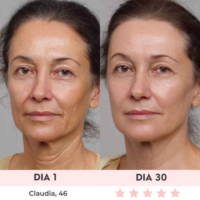 Lift Facial com HIFU – Tecnologia que Ativa o Colágeno e Rejuvenesce o Rosto