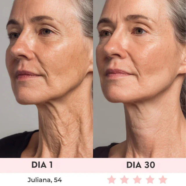 Lift Facial com HIFU – Tecnologia que Ativa o Colágeno e Rejuvenesce o Rosto