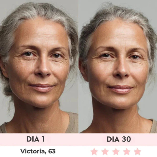Lift Facial com HIFU – Tecnologia que Ativa o Colágeno e Rejuvenesce o Rosto