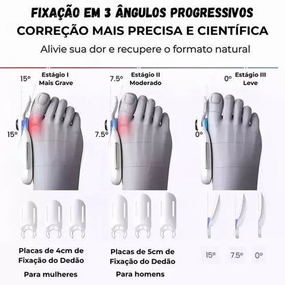 Corretor de Joanete Elétrico Profissional