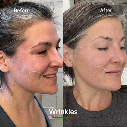 Máscara Facial de Luz LED - DermaLux™