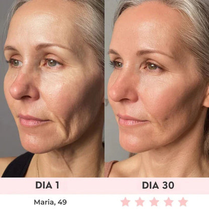 Lift Facial com HIFU – Tecnologia que Ativa o Colágeno e Rejuvenesce o Rosto